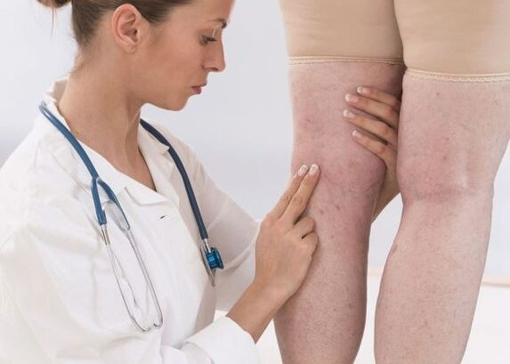 Barizeen diagnostikoa
